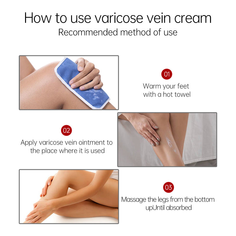 Varicose Veins Relief Cream